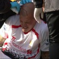 Martin Skrtel gets his head stapled at Bournemouth